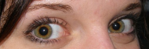 Yeux Rouges Gonflés Quelques Astuces Naturelles Consommer