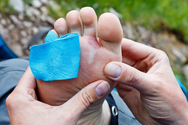 Soigner une ampoule au pied naturellement avec 3 bains de pieds ...