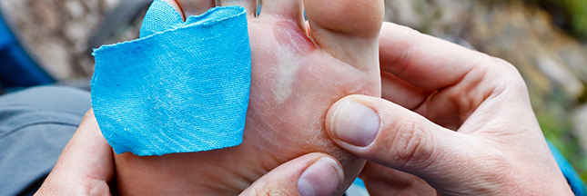 astuce soigner une ampoule au pied soigner une ampoule au pied contre les ampoules des pieds astuce naturelle